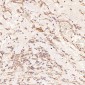 Anti-LC3B MAP1LC3B Rabbit Monoclonal Antibody
